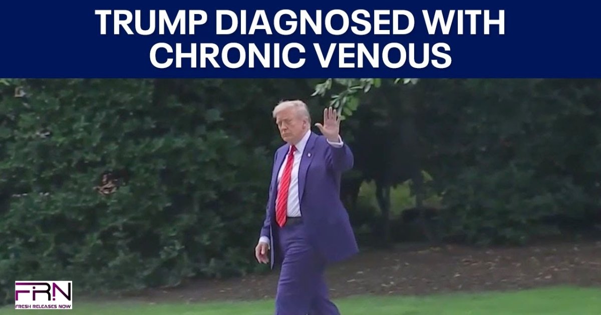 Trump’s Chronic Venous Insufficiency